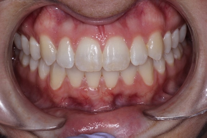 Madeleine E. Johnson (2) - CTG LA - After