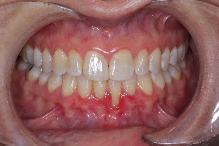 Sarah Blanco (1) - CTG LA - Before (1)