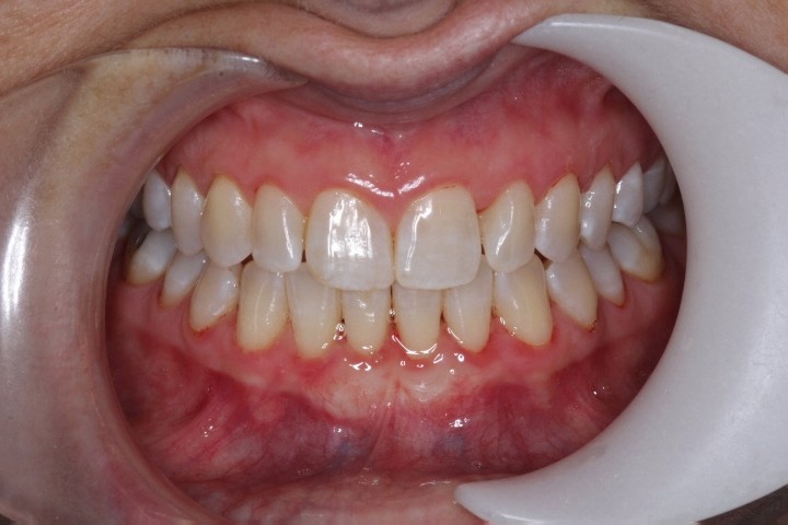 Sarah Blanco (3) - CTG LA - After (1)